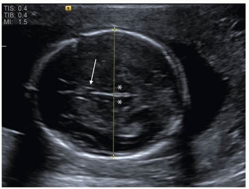 when is the most accurate dating ultrasound