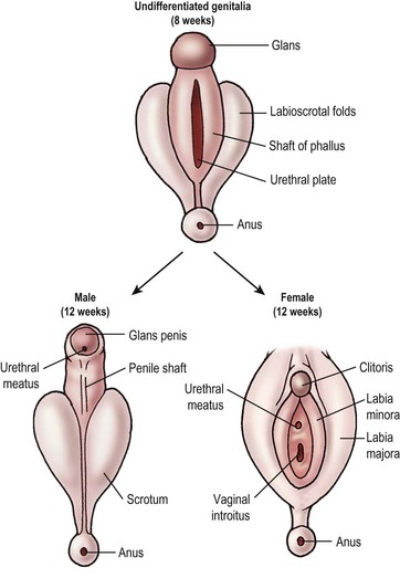 Disorders Of Sexual Differentiation Obgyn Key