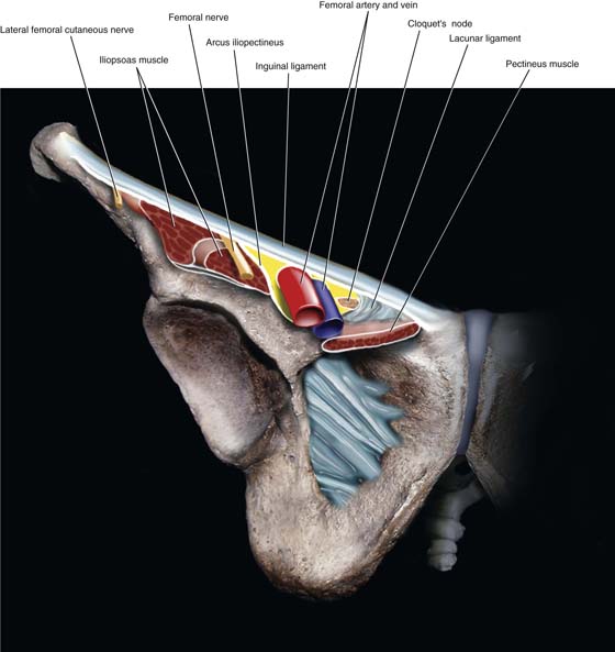 inguinal ligament cadaver