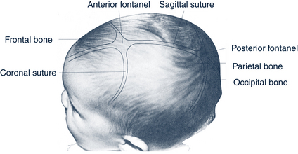 fontanelles sutures assessment figure obgynkey perinatal disorders