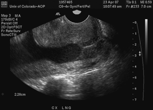 Ultrasound In Obstetrics | Obgyn Key