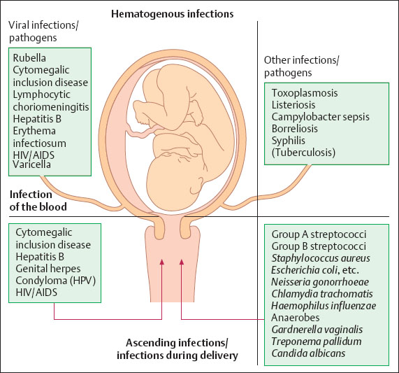 Infections During Pregnancy Obgyn Key