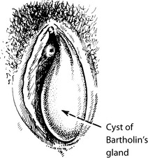 Prolapse And Urogynaecology Obgyn Key