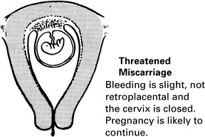 Early Pregnancy Obgyn Key