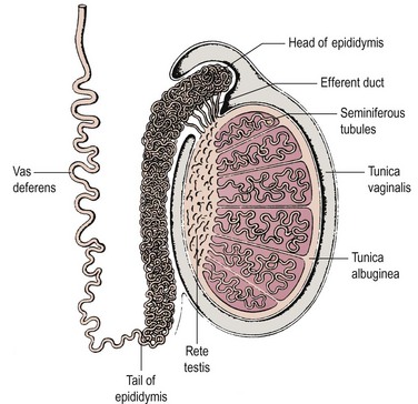 Disorders of male reproduction | Obgyn Key