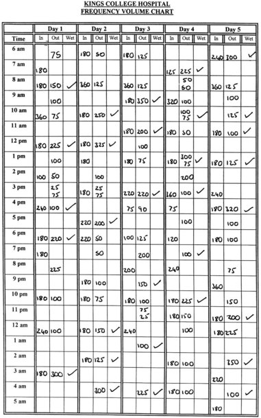 Frequency Volume Chart Interpretation