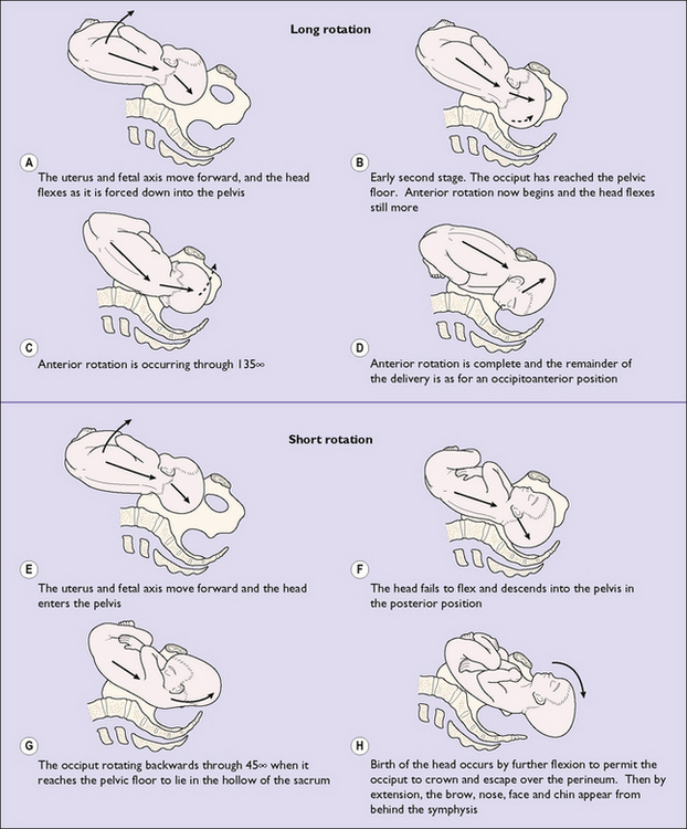abnormal position and presentation of the fetus