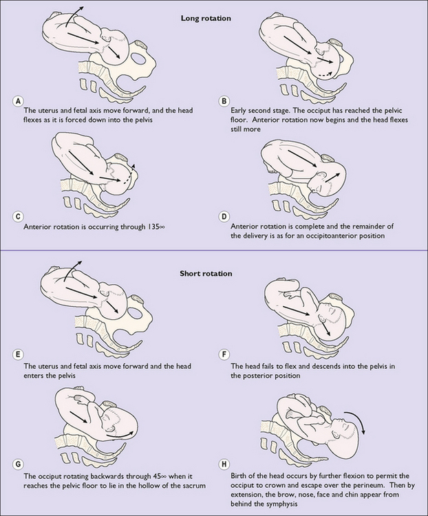 name of abnormal presentation