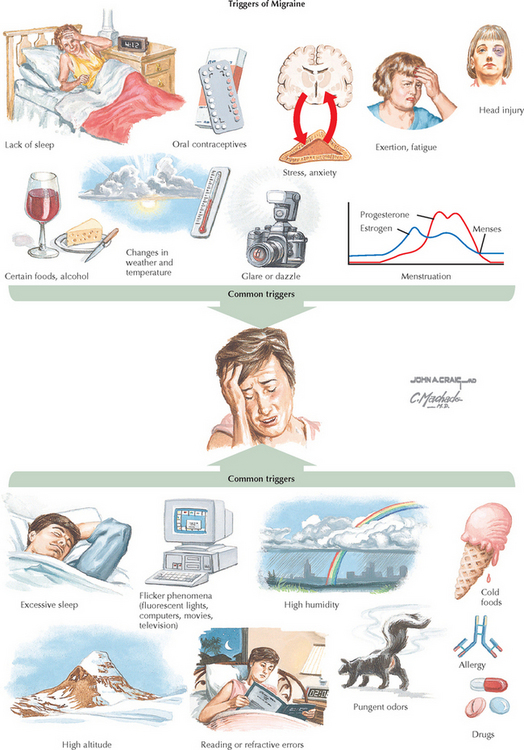 Headache: Tension, Cluster, And Migraine | Obgyn Key