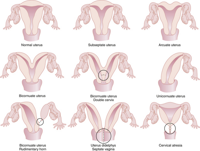 what is congenital defects from the womb