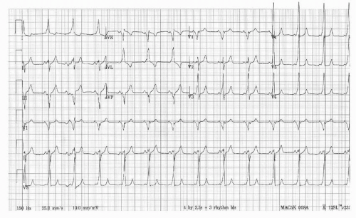 Cardiology | Obgyn Key