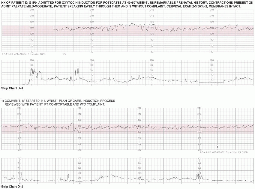 Papier monitoring fœtal Corometrics - DOLPHITONIC