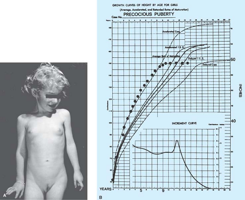 Precocious Puberty Growth Chart