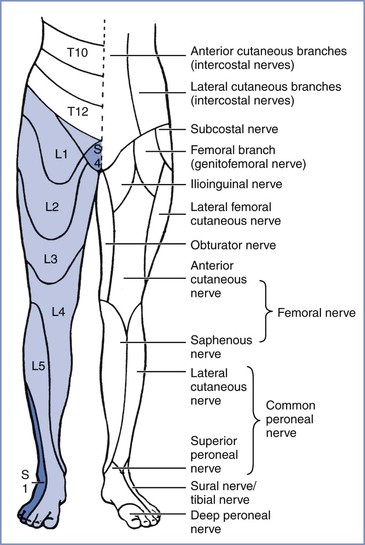 Neurologic Complications of Pregnancy and Neuraxial Anesthesia | Obgyn Key