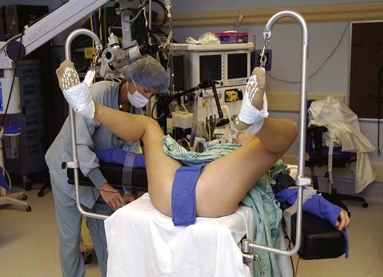 dorsal lithotomy position