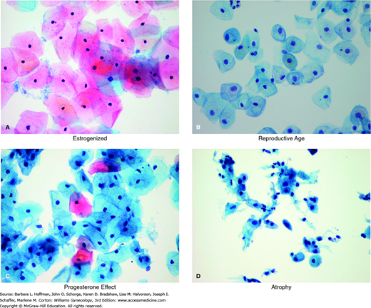 Chapter 21 Menopausal Transition Obgyn Key