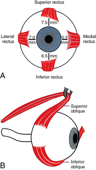 Eyes | Obgyn Key