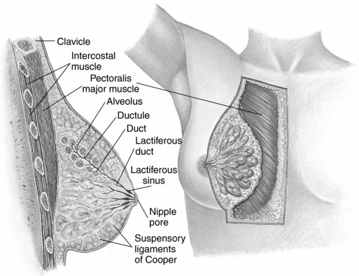 Suspensory Ligaments of Breast (Inferior Medial Quadrant; Left)