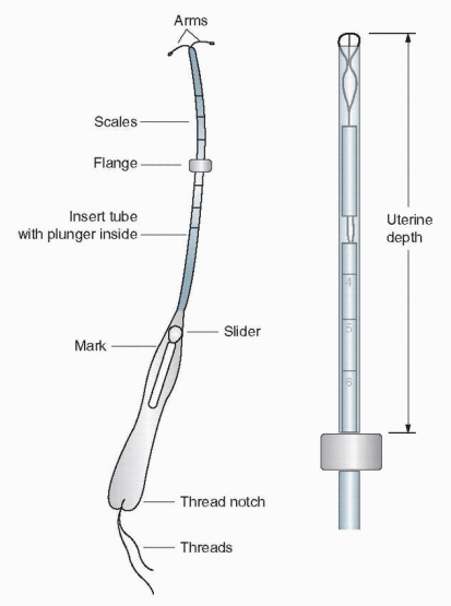 Intrauterine Contraception | Obgyn Key