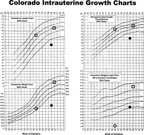 Neonatal Anthropometric Charts