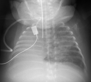 X-rays | Obgyn Key