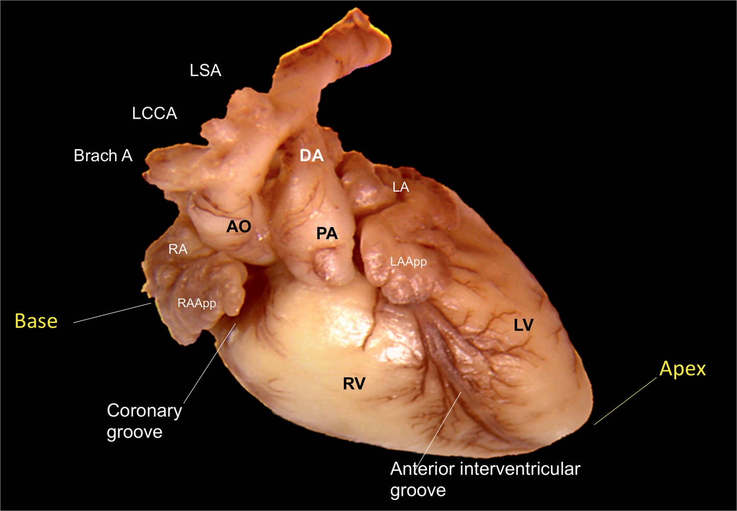 Cardiac Anatomy | Obgyn Key