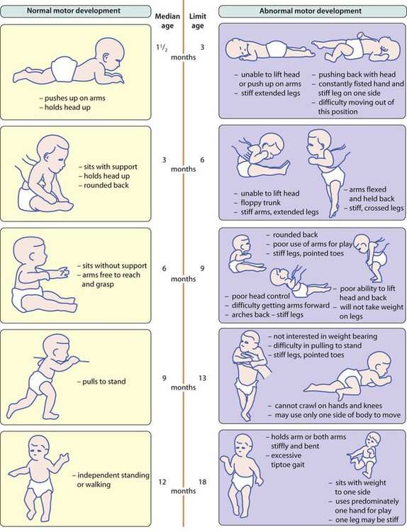 Developmental problems and the child with special needs | Obgyn Key