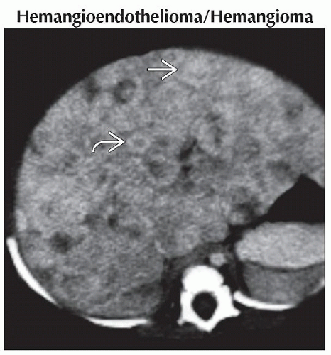 Liver Lesions Causes