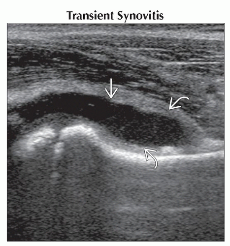 PAINFUL HIP | Obgyn Key