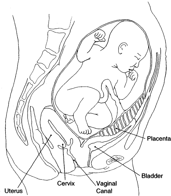 Abdominal Pregnancy Obgyn Key