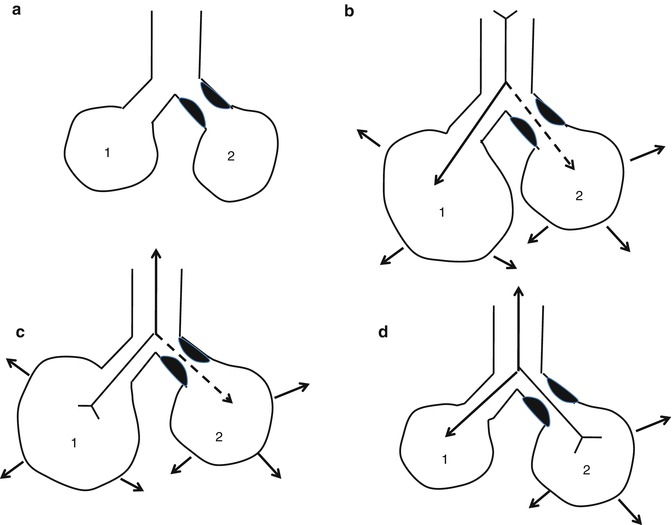 A187909_1_En_11_Fig13_HTML.jpg