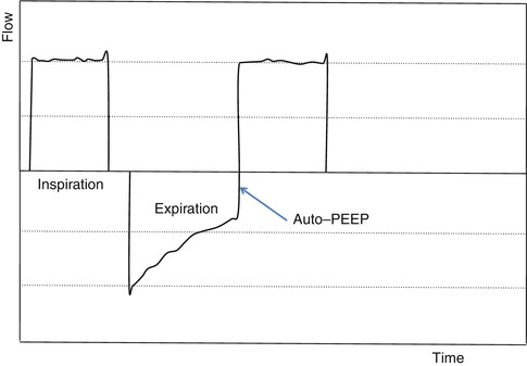 A187909_1_En_11_Fig16_HTML.jpg