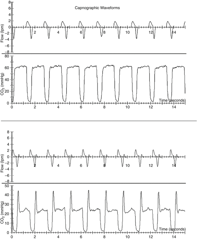 A187909_1_En_12_Fig9_HTML.gif