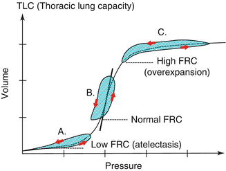 A187909_1_En_13_Fig2_HTML.gif