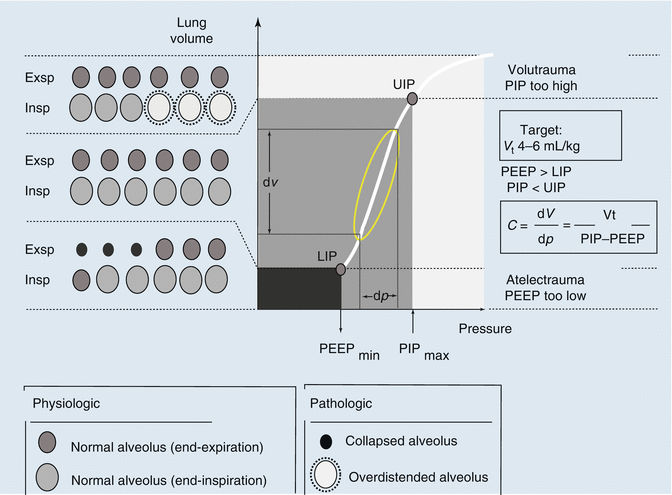 A187909_1_En_13_Fig5_HTML.gif