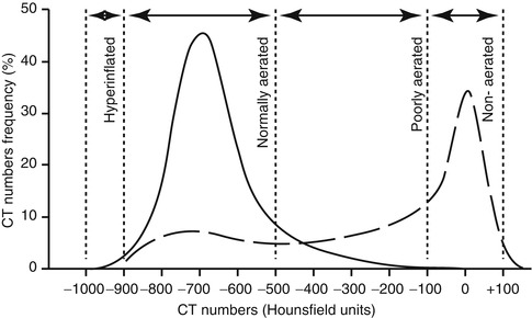 A187909_1_En_14_Fig13_HTML.jpg