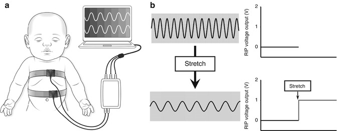 A187909_1_En_14_Fig1_HTML.jpg