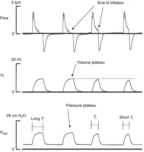 A187909_1_En_21_Fig1_HTML.jpg