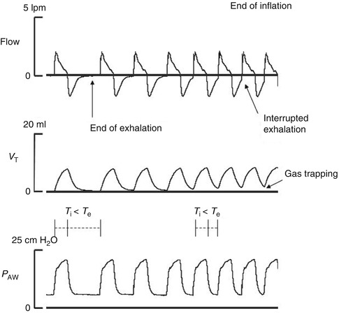 A187909_1_En_21_Fig2_HTML.jpg