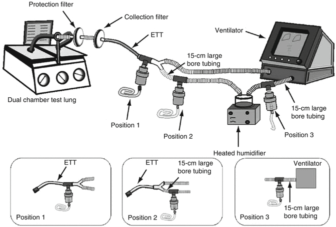 A187909_1_En_30_Fig6_HTML.gif