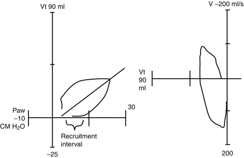 A187909_1_En_44_Fig6_HTML.gif