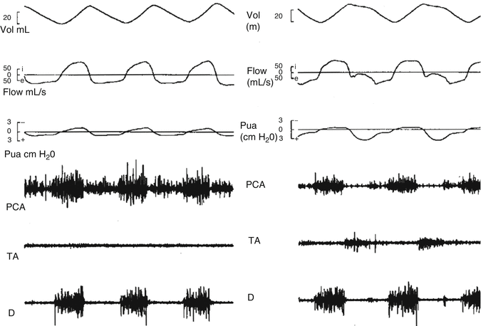 A187909_1_En_4_Fig5_HTML.gif