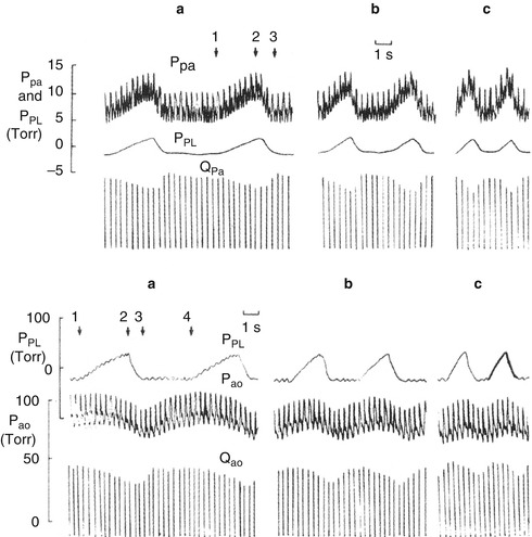 A187909_1_En_53_Fig3_HTML.jpg