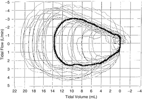 A187909_1_En_67_Fig3_HTML.jpg