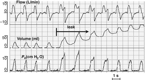 A187909_1_En_8_Fig26_HTML.jpg