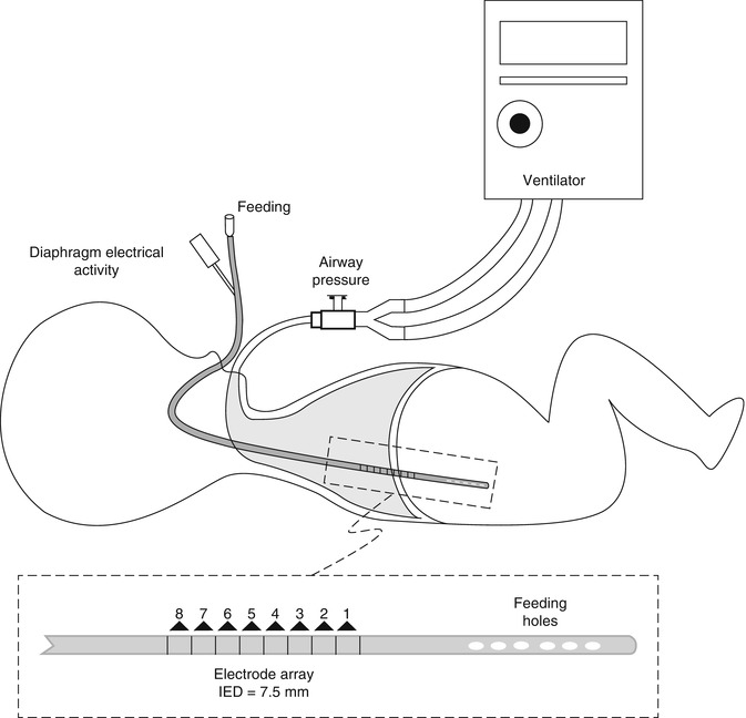 A187909_1_En_8_Fig29_HTML.jpg