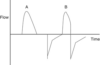 A187909_1_En_8_Fig3_HTML.jpg