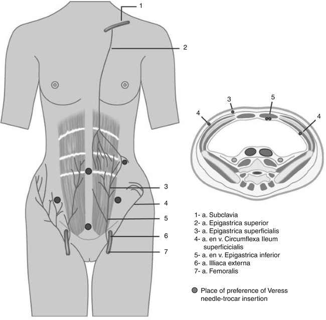 A304172_1_En_20_Fig2_HTML.jpg