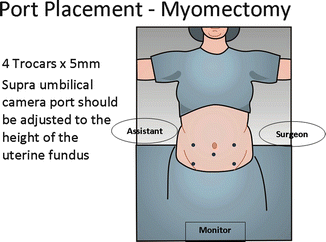 how long does it take to get a flat stomach after myomectomy