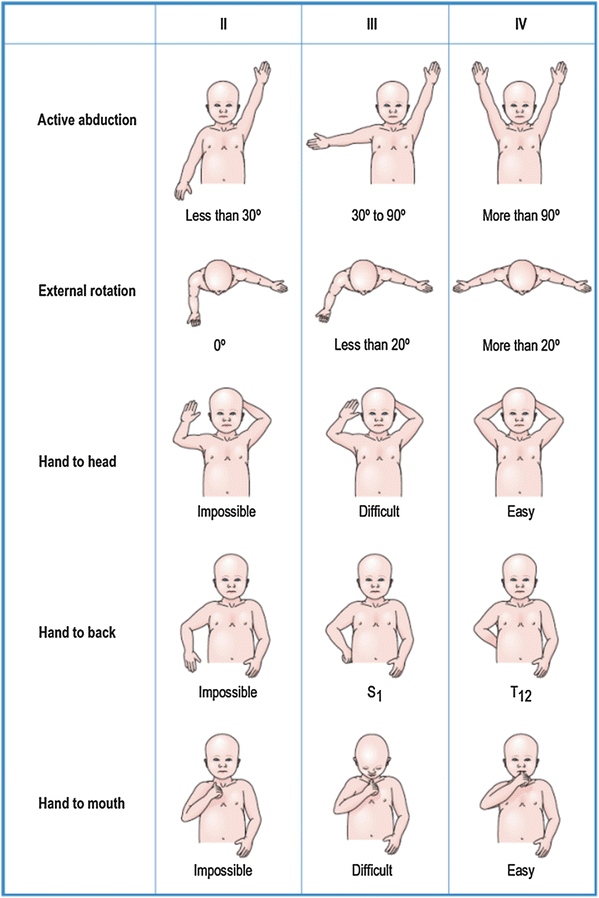 Waiters Tip Brachial Plexus